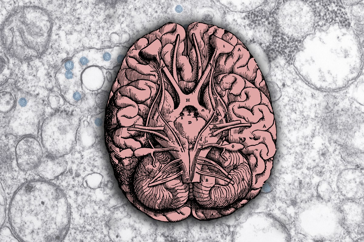 What happens to your brain when you learn a&nbsp;language?